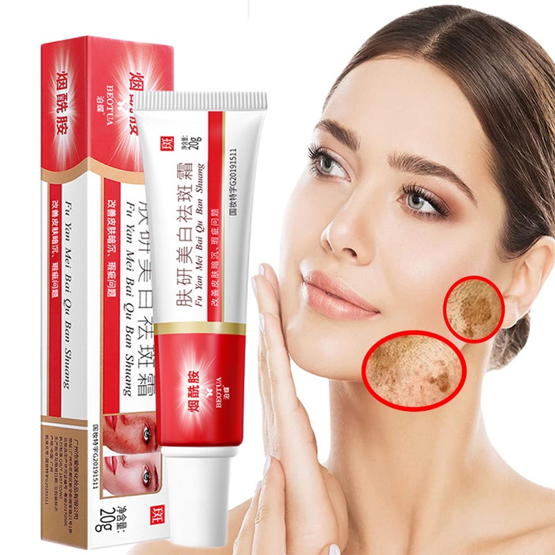 Whitening Freckle Cream Remove Dark Spots Anti Freckle Cream Niacinamide Fade Pigmentation Melasma Brighten Creams concealer