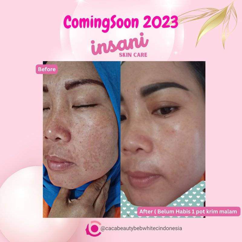 INSANI SKINCARE ACNE DAN GLOW