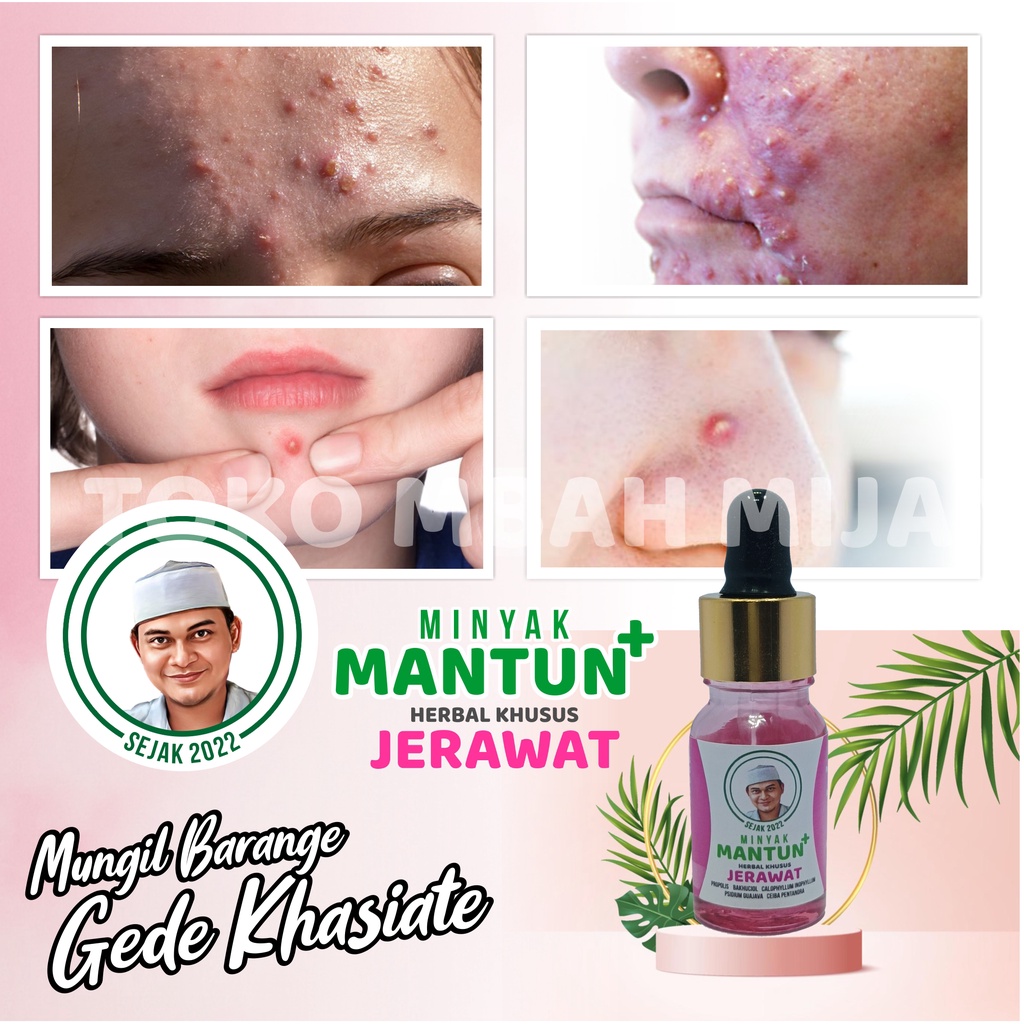 Mantun Pink Herbal Jerawat Batu