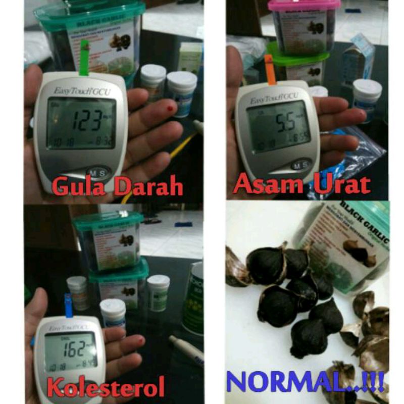 Black garlic bawang hitam bawang tunggal 250 gram