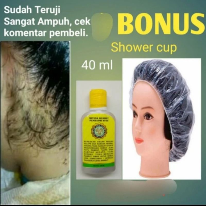 Grosir...100% Original 10 Pcs Obat kutu rambut herbal bukan peditox