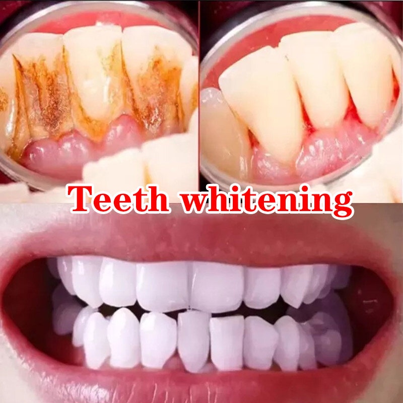 Pasta Gigi Pemutih Teeth Whitening Toothpaste Pemutih Gigi Pembersih Gigi Kuning Mencegah Kerusakan Gigi Pasta Gigi Anak Nafas Segar Menghilangkan Penghilang Bau Mulut Perontok Karang Gigi Pasta Gigi Ceri Memutihkan gigi