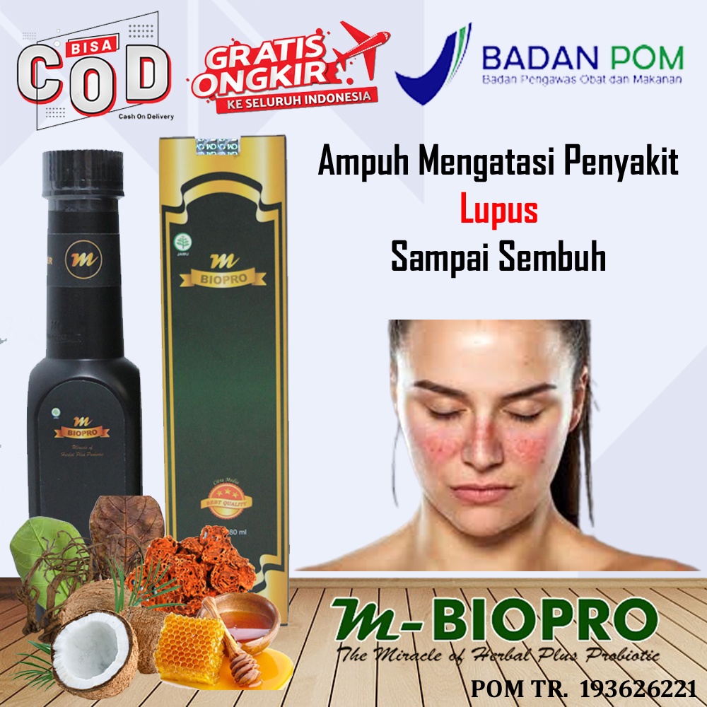Obat Herbal Penghilang Lupus, Obat Lupus Autoimun, Ruam Di Wajah, Odapus, Gatal Gatal Di Pipi Wajah,