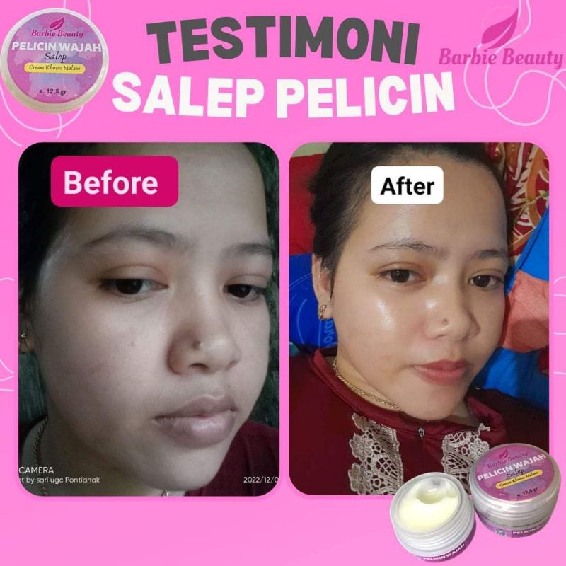 SALEP PELICIN DAN SUNSCREEN BARBY BEAUTY/ BERBY BEAUTY