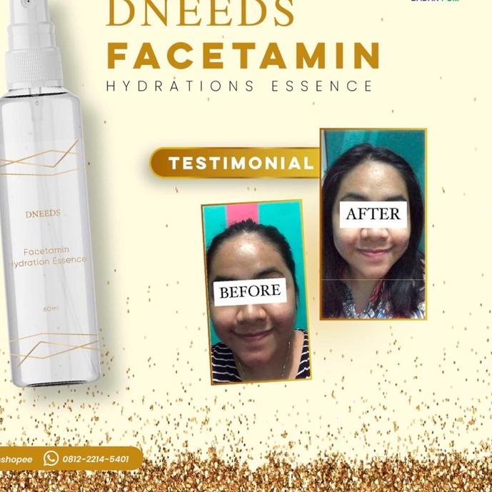 ➱ DNEEDS FACETAMIN ESSENSE ♙