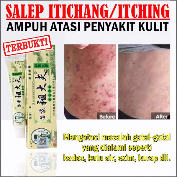 Salap gatal cina itichang itching obat kulit alergi gatel eksim kadas kurap dan jamur ampuh
