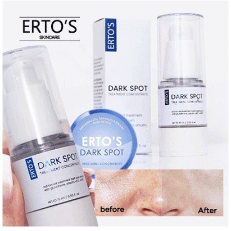 SERUM PENGHILANG FLEK HITAM ERTOS DARK SPOT SERUM 15ML ORIGINAL DARK SPOT SERUM ERTOS