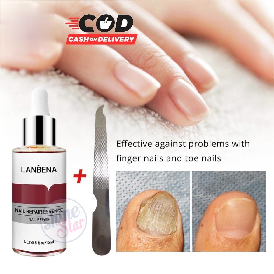 BISA COD !!! Lanbena Nail Repair Serum Jamur Perawatan Kuku Perawatan Tubuh 15ml Original