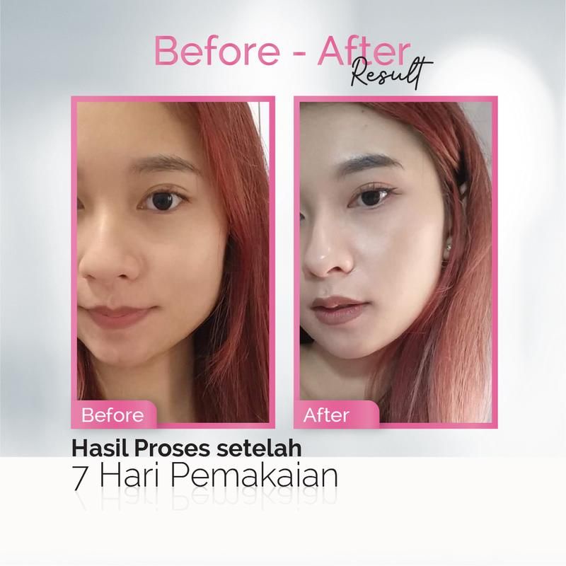 Animate Whitening Series 5in1 - Cream Pemutih Wajah - Skincare Wajah