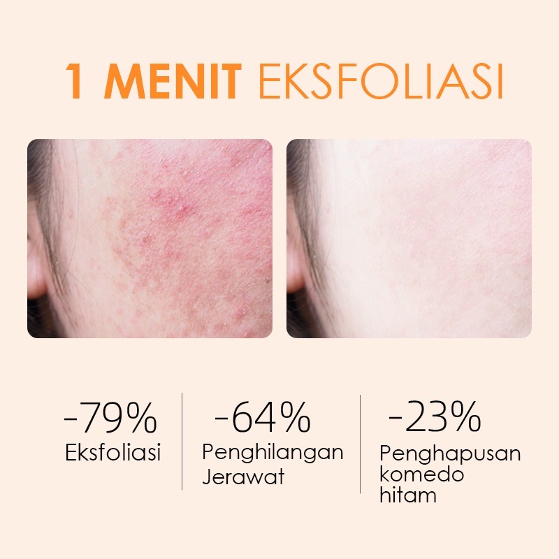 Exfoliating GMEELAN Centella Asiatica Peeling Gel Facial Glowing Blackhead Cleaner Body Exfoliating Mencerahkan