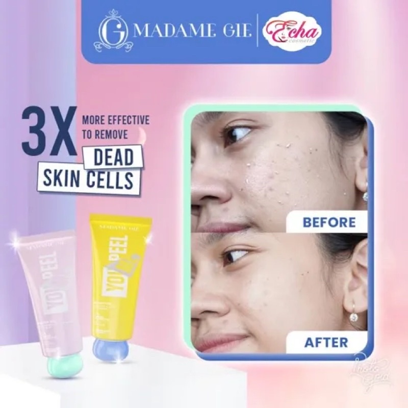 Madame gie peeling gel