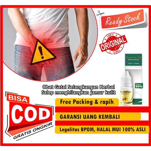 Propolis SM - Obat Gatal Selangkangan Herbal, Salep menghilangkan jamur kulit, obat kurap di Selangk