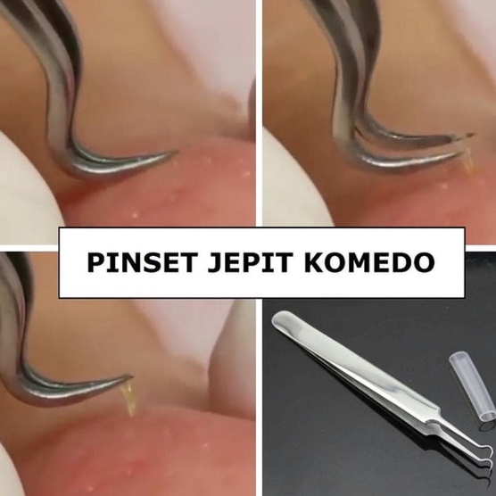 PA Pinset Jepit Komedo Stainless Steel Blackhead Tweezer / Alat Capit Untuk Menghilangkan Komedo / Penjepit PR121