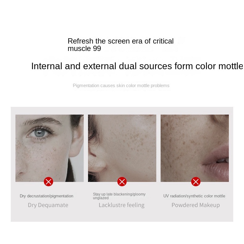 SISKALEY Nicotinamide Whitening Serum Freckles Remove Dark Spots Melasma Brighten Lighten Melanin Improve Dull Anti-Aging 15ml