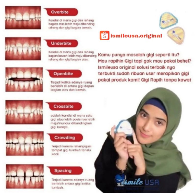 Ismile USA Original/Perapih Gigi Original/Perapi Gigi original/Retainer Gigi/Teeth Trainer/Aligner g