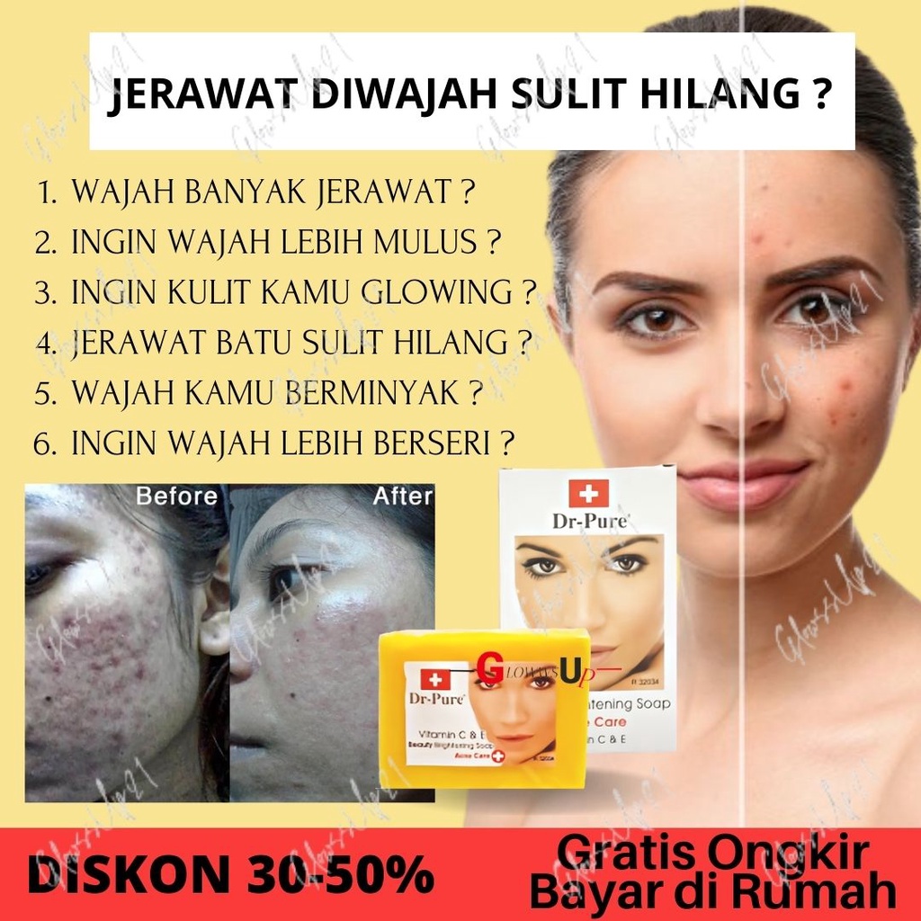 SABUN WAJAH BERJERAWAT DR PURE ACNE CARE BEAUTY BRIGHTENING SOAP BPOM - SABUN JERAWAT DR PURE