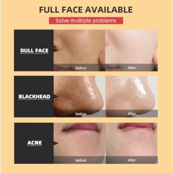 BIOAQUA Masker Lengkap - Rose Petals - Moisturizing Tear Type - Yeast Collagen - Carbon Peel Off Mask