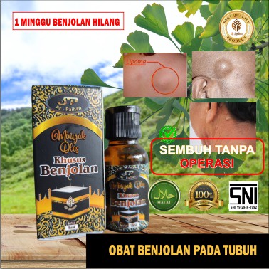 𝗠𝗜𝗡𝗬𝗔𝗞 𝗕𝗘𝗡𝗝𝗢𝗟𝗔𝗡 Racikan dokter , paling ampuh untuk be benjolan 𝗢𝗕𝗔𝗧 𝗕𝗘𝗡𝗝𝗢𝗟𝗔𝗡  / 𝗠𝗜𝗡𝗬𝗔𝗞 𝗢𝗟𝗘𝗦 𝗔𝗥 𝗥𝗔𝗜𝗛