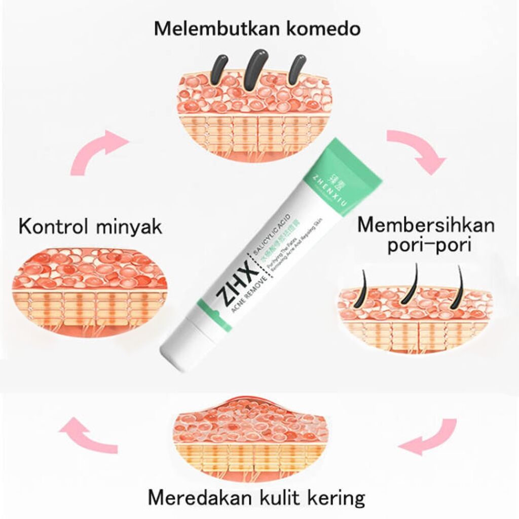 Obat Jerawat Penghilang Bekas Jerawat Bpom Acne Cream Skin Care Salep Jerawat Dan Bekas Jerawat Paling Ampuh