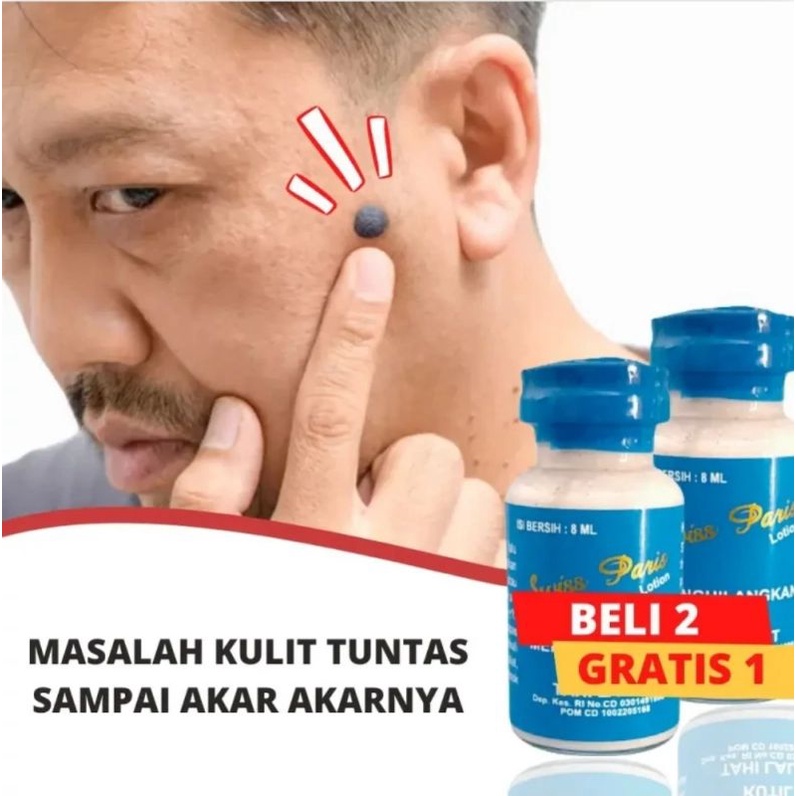 Salep Kutilat Penghilang Kutil Dan Tahi Lalat 100% Ampuh Organik