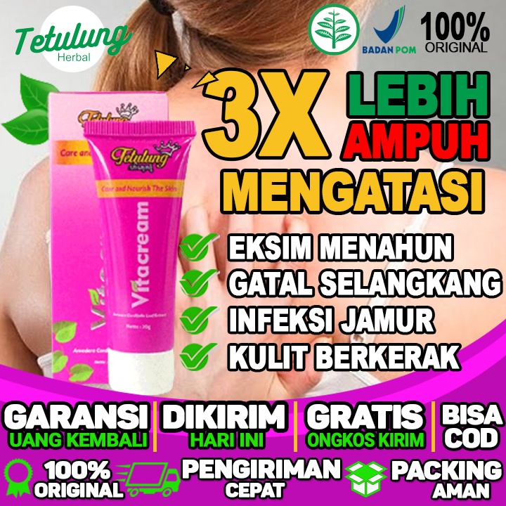 Obat Salep Vitacream Menghilangkan Gatal Selangkangan Dan Menghilangkan Gatal Karena Infeksi Jamur