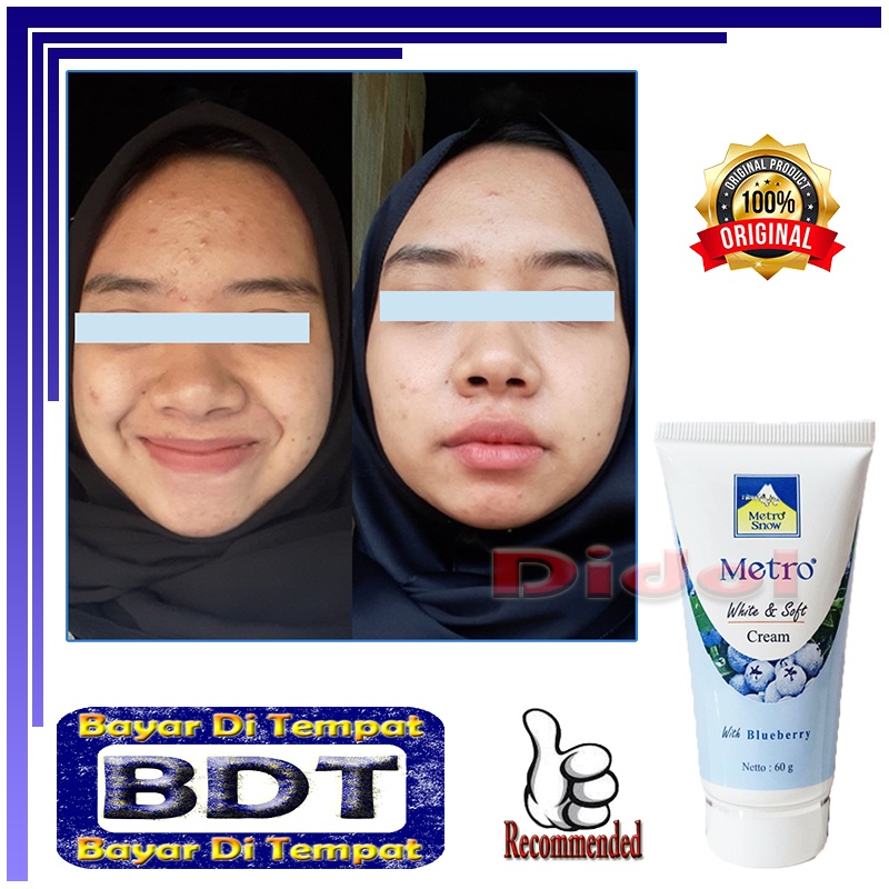 Cream Metro Snow Ekstrak Blueberry Penghilang Flek atau Bintik Hitam Krim Pemutih Kulit Wajah BPOM C