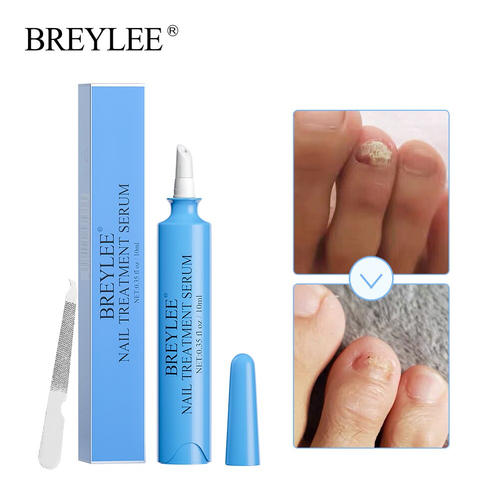 (READY &amp; ORI) BREYLEE NAIL TREATMENT SERUM PERAWATAN KUKU BY 5736