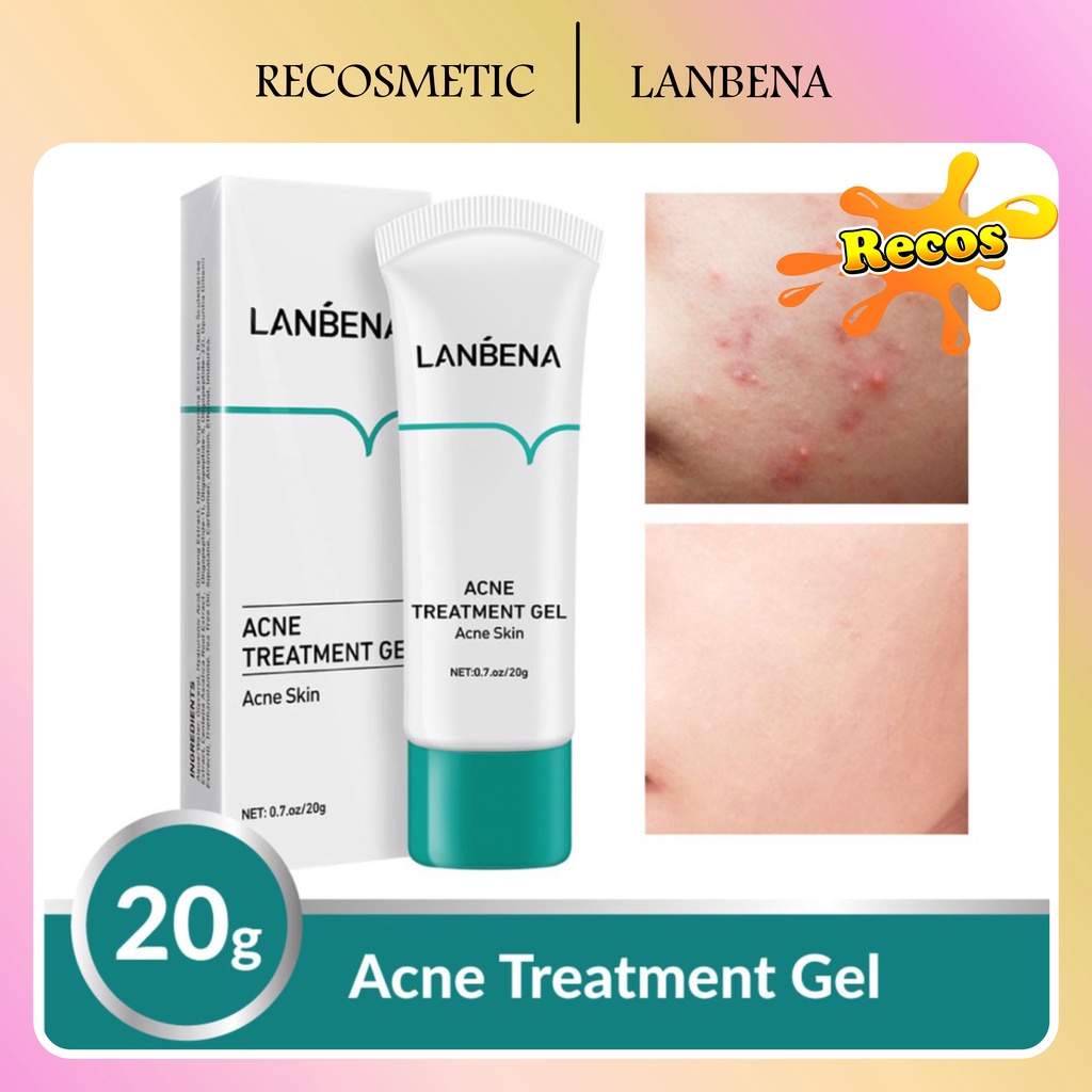 [BPOM] LANBENA Gel Treatment - Wajah Berjerawat (20 g)