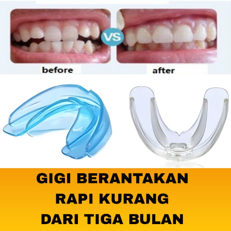 Perapi Gigi Gingsul Tonggos | TEETH TRAINER ORIGINAL Tanpa Behel Kawat