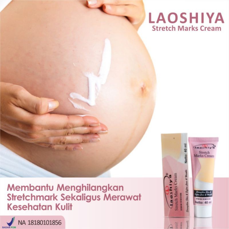 PENGHILANG BEKAS TANDA MELAHIRKAN STRETCH MARK CREAM LAOSHIYA MENYAMARKAN MENGHILANGKAN SELULITPADA 