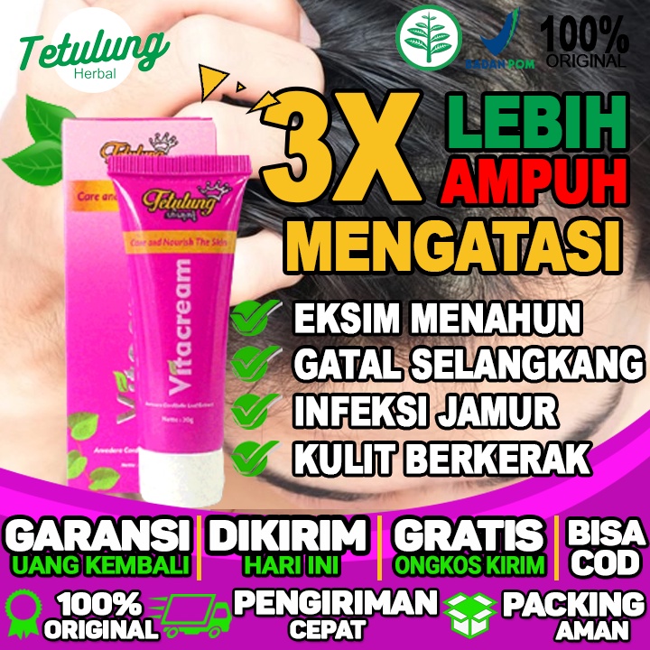 Obat Salep Gatal Pada Kepala Akibat Infeksi Jamur Dan Menghilangkan Kulit Berkerak