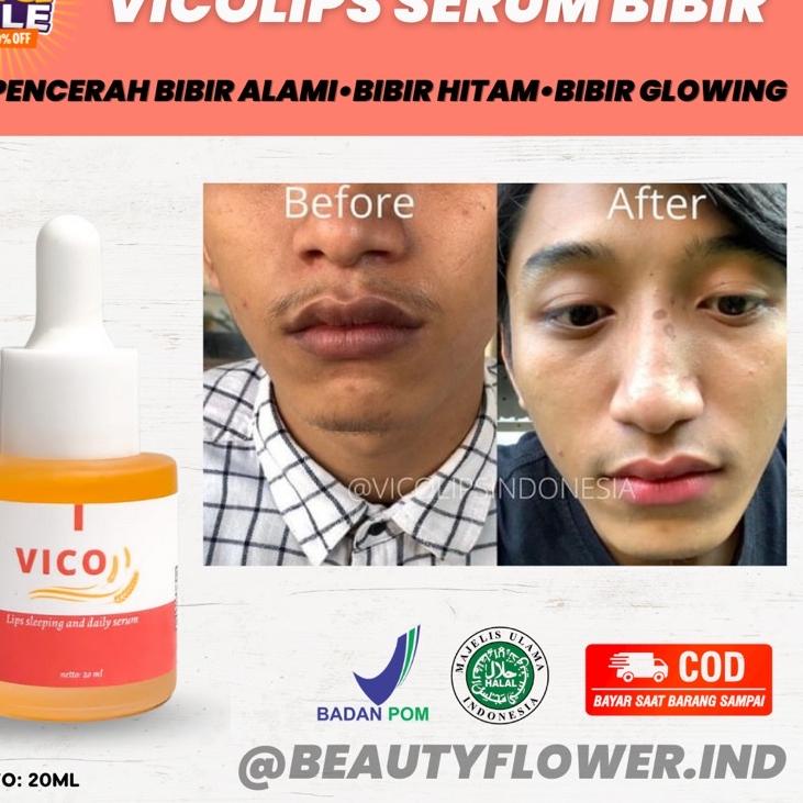 ➳ VICO LIPS SERUM BIBIR ORIGINAL | PENCERAH BIBIR | SERUM BIBIR | PEMERAH BIBIR | PEMERAH BIBIR PERM