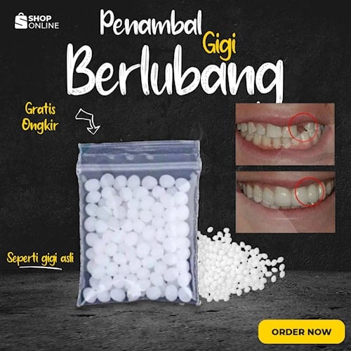 Gigi Palsu Snap On Smile Atas Bawah ORIGINAL Authentic 1 Set Lem Penambal Gigi Berlubang Gigi Ompong Cp01 L.S