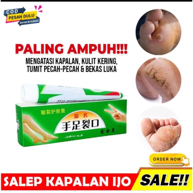 Salep Kaki Rayapan Kaki Bolong2 Kering Pecah Pecah Parah Cream Tumit Kaki Kutu Air Rayapan