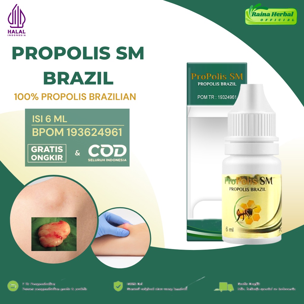 Jual Propolis Sm Obat Herbal Lipoma Minyak Oles Lipoma Shopee Indonesia