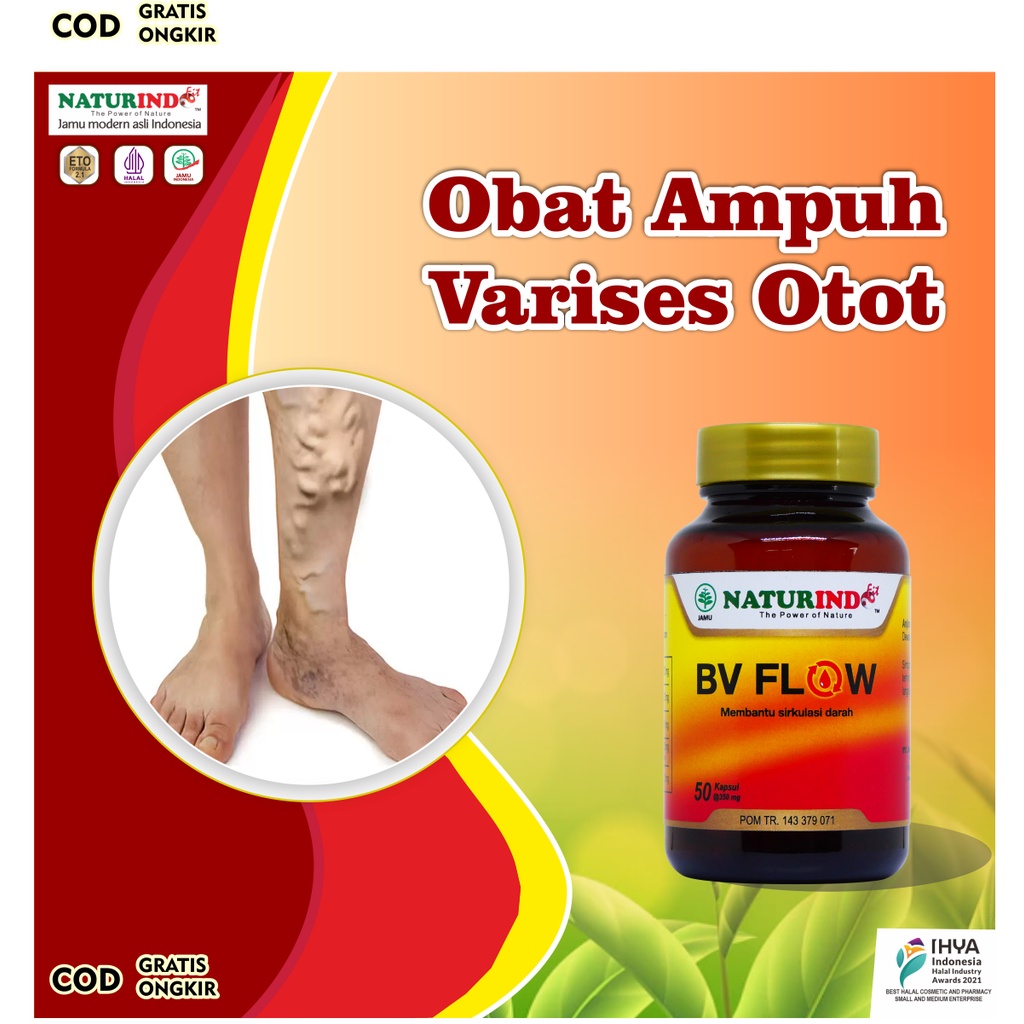 Jual Obat Varises Paling Ampuh Herbal Otot Kaki Bengkak Farises Di