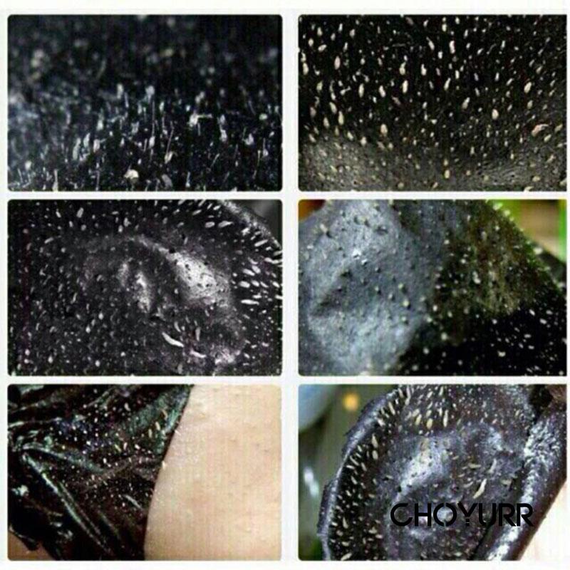 【COD】Charcoal Anti Blackhead / Peeler Blackhead / Masker Komedo / Blackhead Care Mask / Pembersih Komedo/ Ampuh Penyedot Comedo / Penghilang Komedo -CH