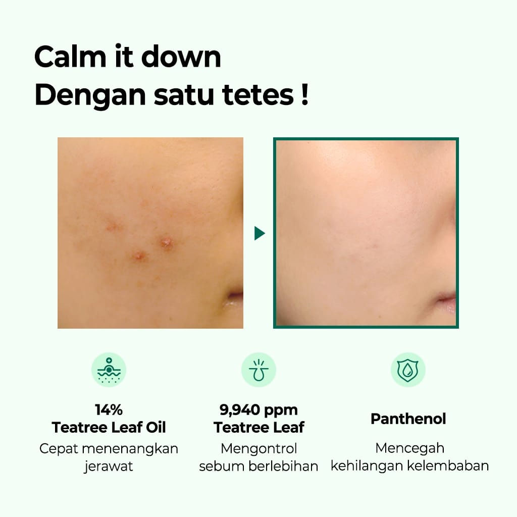 Some By Mi Aha Bha Pha 30 Days Miracle Tea Tree Clear Spot Oil