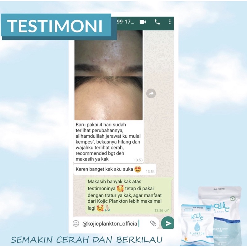 KOJIC PLANKTON - Kojie Bright &amp; Glow Face Soap Go To Bright and Glow Body Serum Sabun Body Lotion Pembersih Pemutih Pencerah Penghilang Bekas Jerawat Wajah Aman Original Viral BPOM