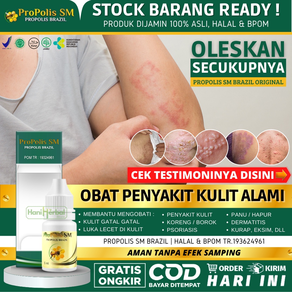 Obat Gatal Selangkangan Kering Basah Lecet Berjamur - Obat Eksim Menahun - Obat Gatal Gatal di Panta