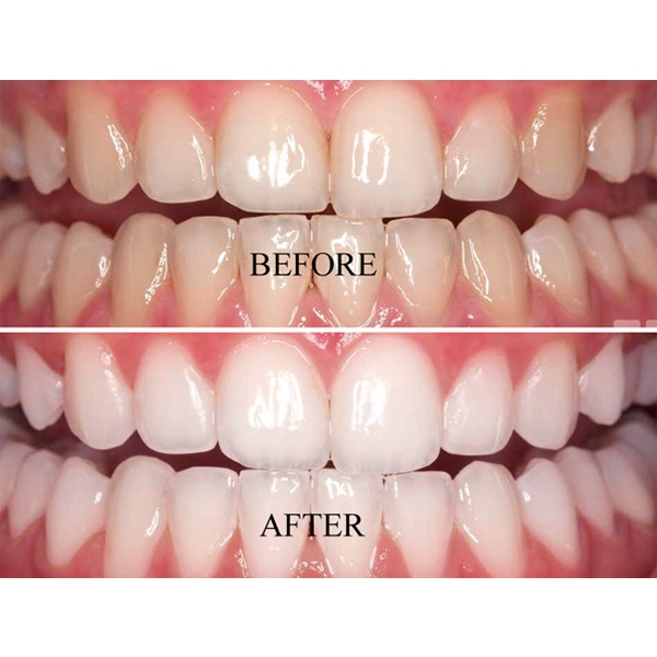 TEETH WHITENING/ PEMUTIH GIGI 30gr_Cerianti