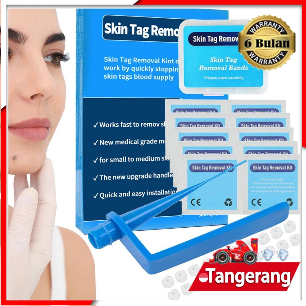 Skin Tag Remover Wart Remover Wart Removal High Quality Tools Kit 1Set