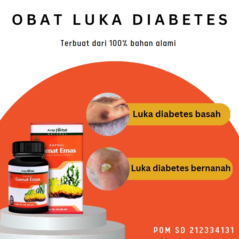 Kaka Herbal - Obat Luka Diabetes, Obat Luka Diabetes Kering Basah, Obat Pengering Luka Diabetes, Oba