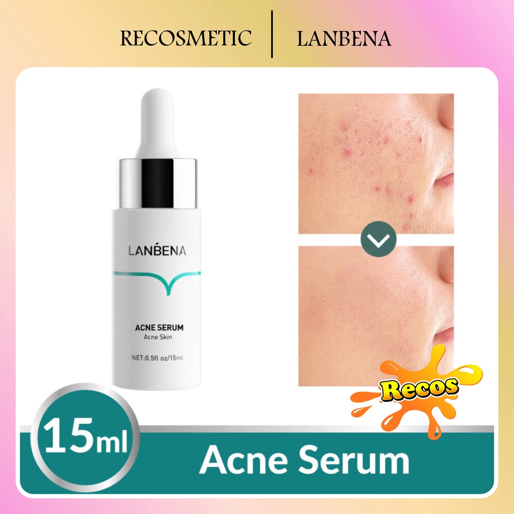 LANBENA Acne Serum - Wajah Berjerawat (15ml)