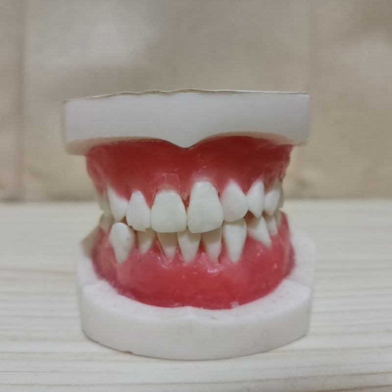 Jual Ready Typodont Dental model gigi Typodont Orto orthodontic wax