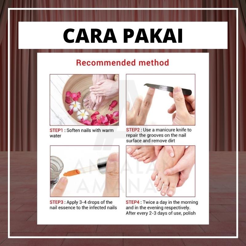 Lanbena Nail Repair Essence Serum Perawatan Jamur Kuku Lanbena Nail Repair Essence Perawatan Kuku Jamuran Manicure Pedicure Pemanjang Kuku Kaki