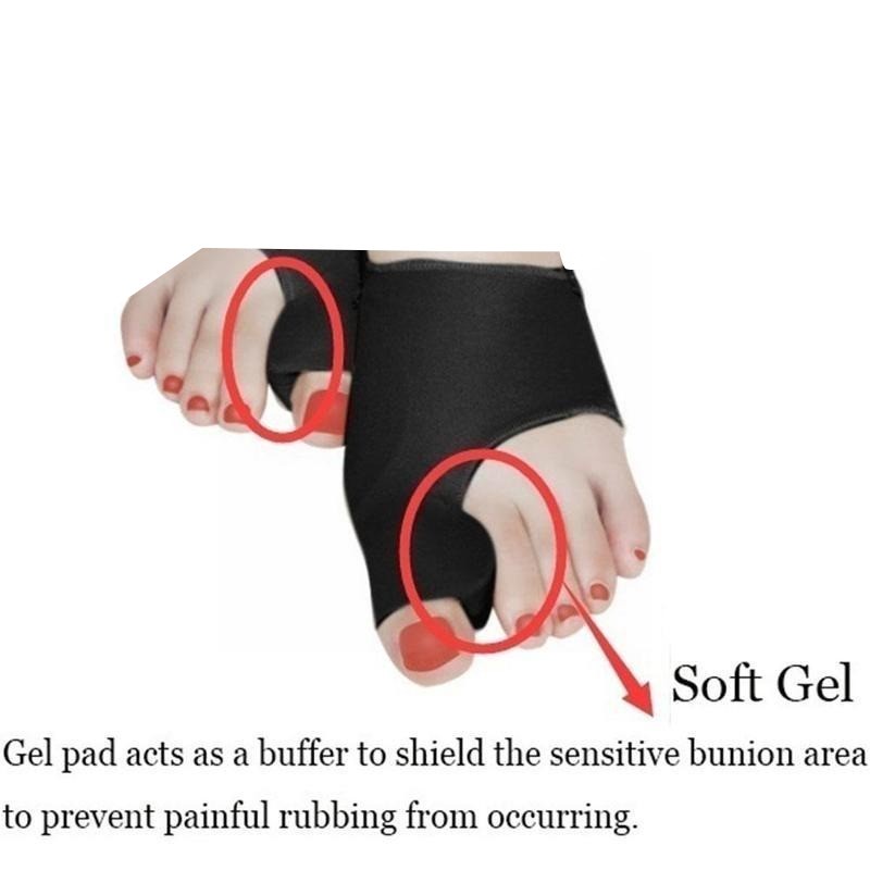 PELURUS JEMPOL KAKI HALLUX VALGUS BUNION CORRECTOR SLEEVE KOREKTOR TULANG JEMPOL 2 PCS (SEPASANG)