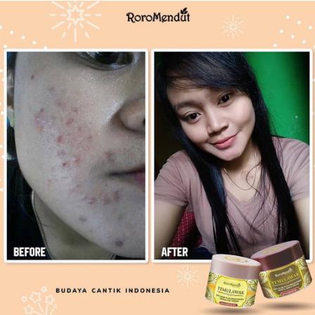 * NCC * Roro Mendut Paket Starter Temulawak Day Cream Night Cream Soap Bar Skincare Skin Care