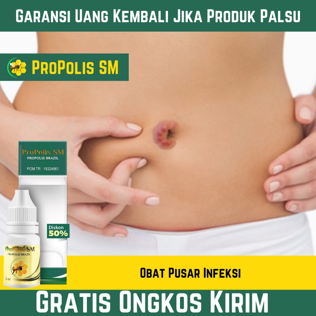 Obat Pusar Infeksi , Pusar Berair Dan Bau , Pusar Bernanah , Luka Pada Pusar , Udel Berdarah | PROPO