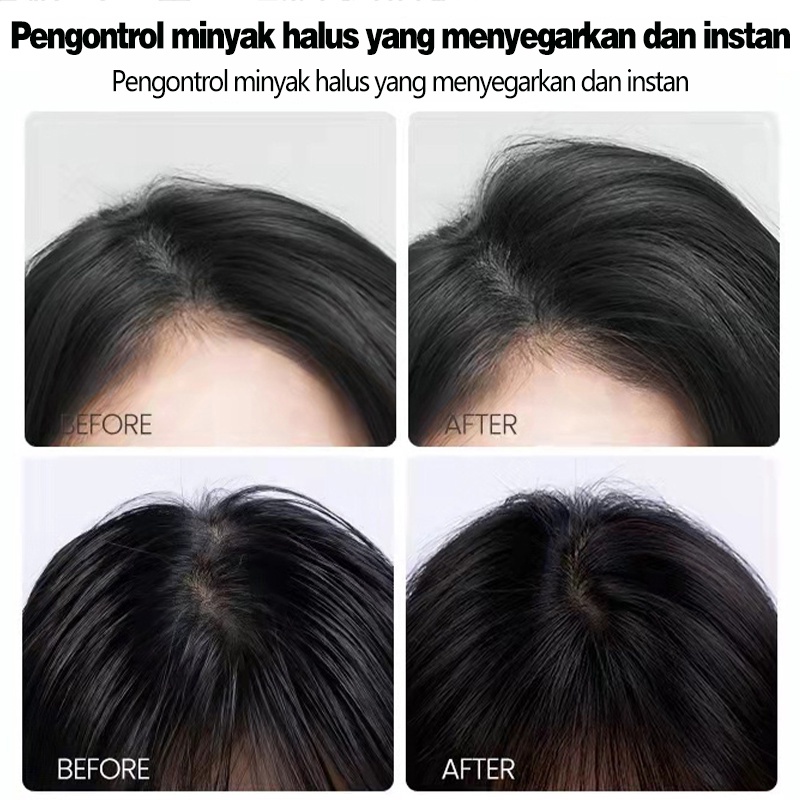 Dry Shampoo Spray 150 ML Semprotan Rambut kering untuk minyak rambut Kontrol rambut berminyak Fluffy hair NyamanTersedia untuk ibu hamil